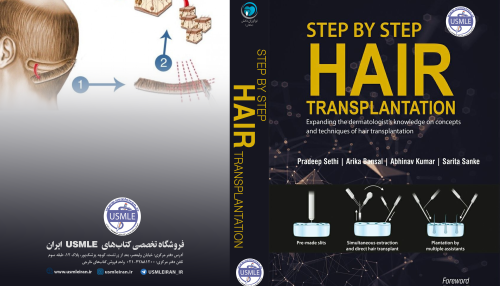 Step by Step Hair Transplantation (کیفیت چاپ سوپرپیکسل)