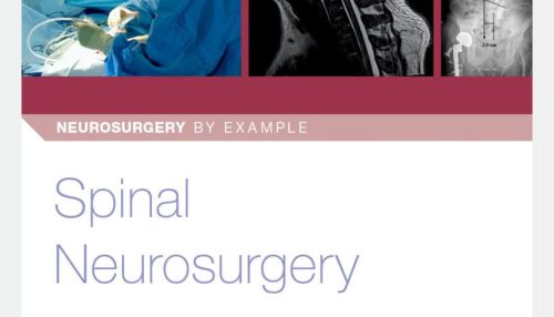 Spinal Neurosurgery