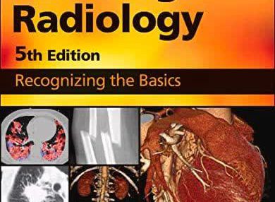Learning Radiology Recognizing the Basics