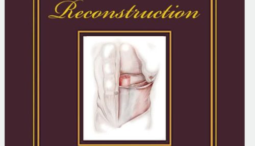 ADVANCES IN ABDOMINAL WALL Reconstruction