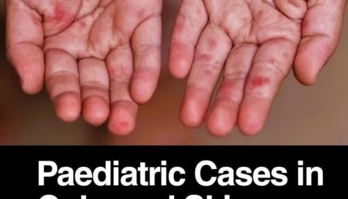 Paediatric Cases in Coloured Skin 1st Edition