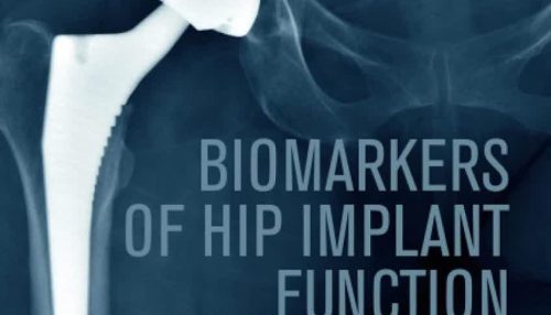 Biomarkers of Hip Implant Function 1st Edition