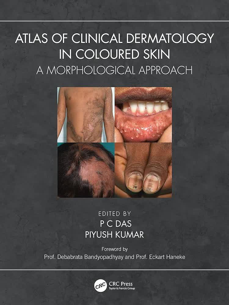 Atlas of Clinical Dermatology in Coloured Skin: A Morphological Approach 1st Edition