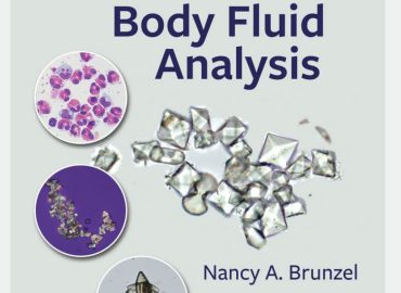 Fundamentals of Urine & Body Fluid Analys - مقدمات آنالیز ادرار و مایعات بدن