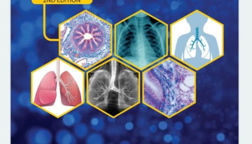 Pediatric Pulmonology 2ND EDITION - بیماری های ریه در اطفال ویرایش دوم نسخه ۲۰۲۴
