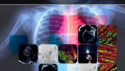 کتاب Heart Failure in the Child and Young Adult: From Bench to Bedside